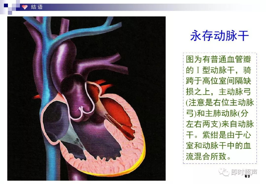 最新心脏解剖学研究进展及其对健康的重要影响探究