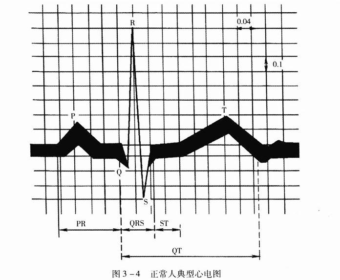 最新心电图解读，心电图特点及其应用详解