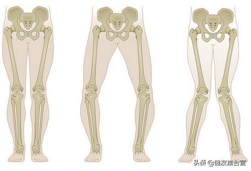 最新关于轻度小耳畸形的探索及其发展趋势预测分析