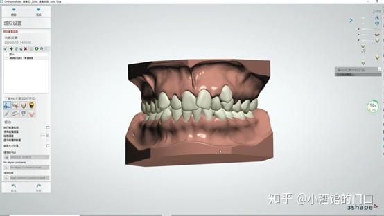 最新牙齿模型技术概览与趋势分析