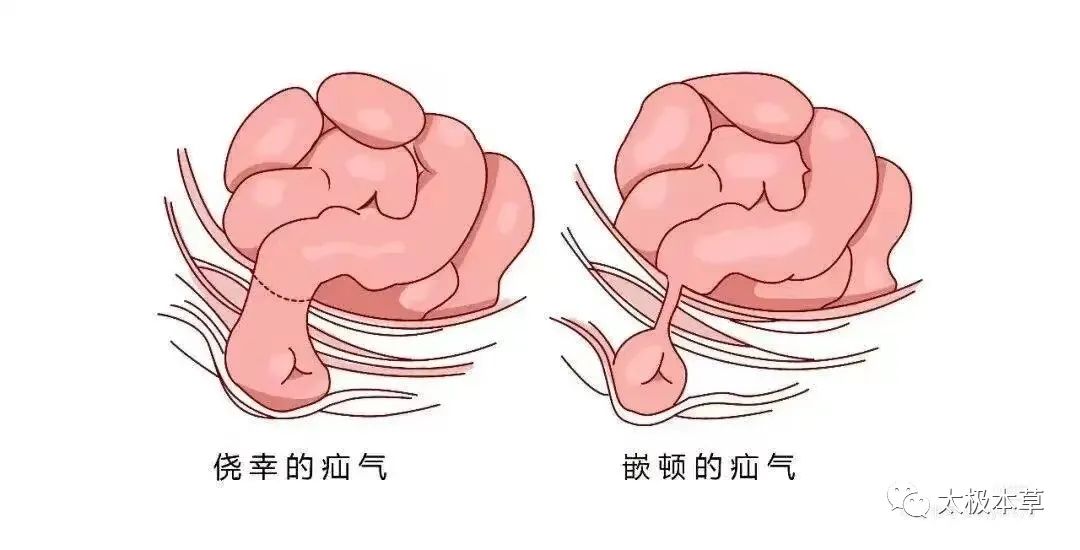 破晓之光